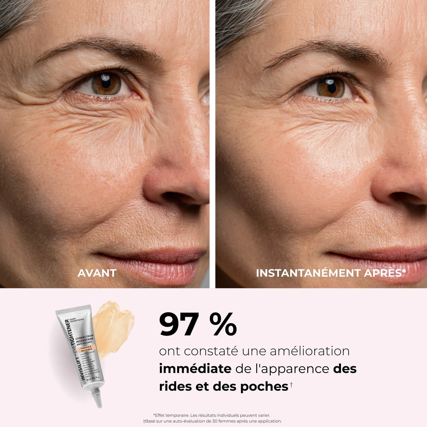 InvisiLift™ - Réduit les Poches & Ridules dès 3 minutes.