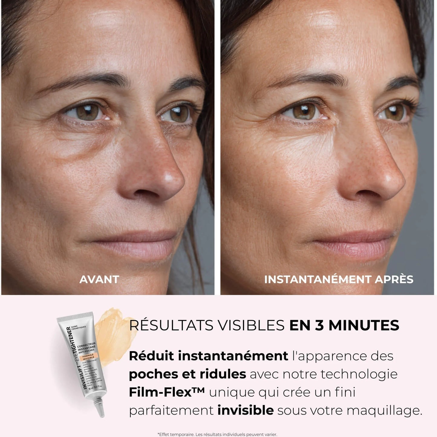 InvisiLift™ - Réduit les Poches & Ridules dès 3 minutes.