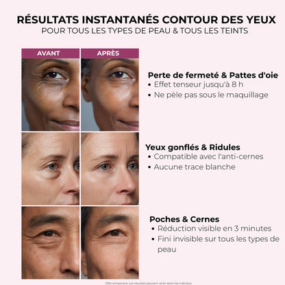 InvisiLift™ - Réduit les Poches & Ridules dès 3 minutes.